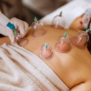 Cupping Therapy Massage Certificate Course | 4 CEU
