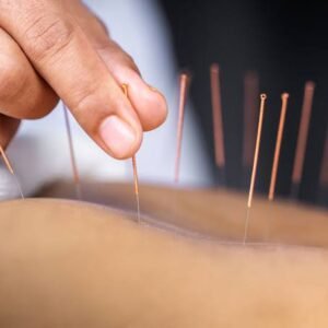 Medical Acupuncture Treatment & Training Course